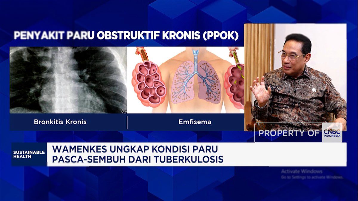 Penyakit Paru: Ancaman Kesehatan yang Membebani Keuangan Negara